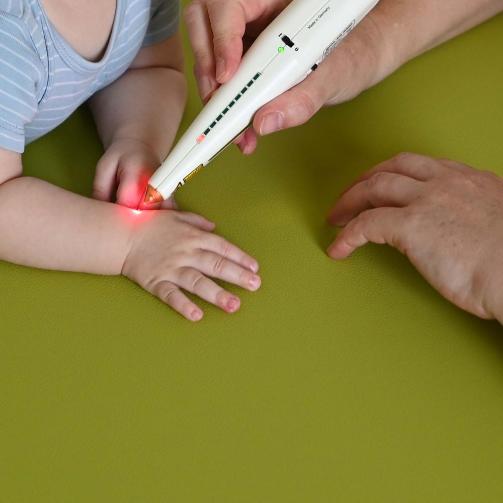 Laserbehandlung am Baby